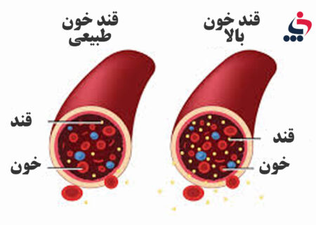 ایا شما هم جزو بیش از ۷.۵ میلیون نفر مبتلا به دیابت در کشور هستید؟